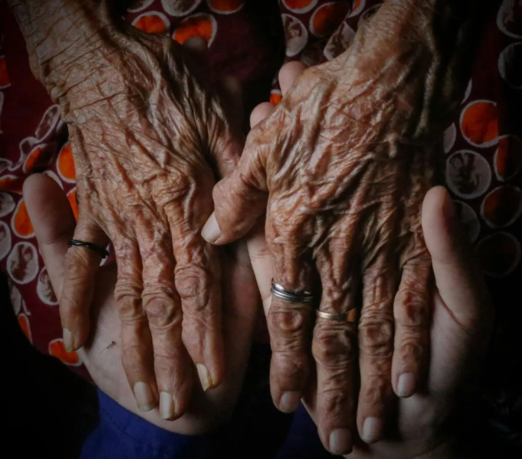 reason behind skin wrinkling with age